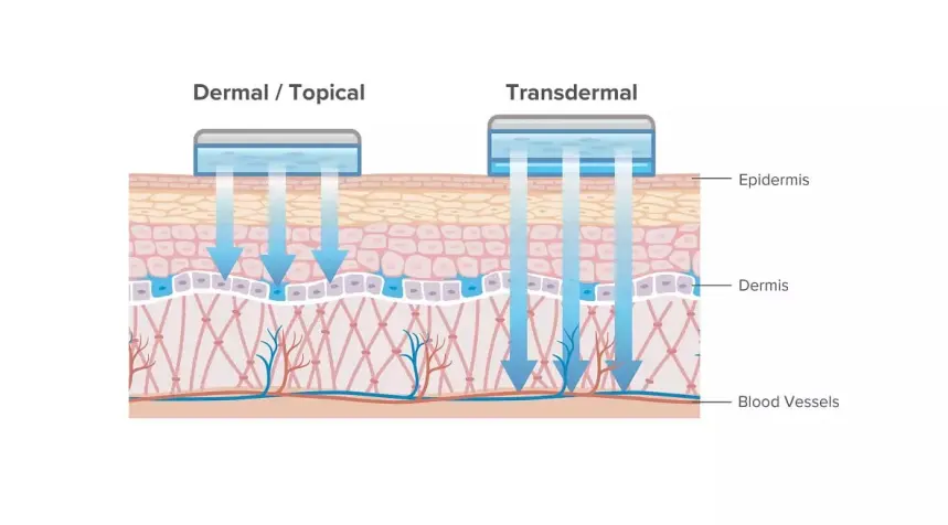 Pharmaceutical Transdermal Drug Development